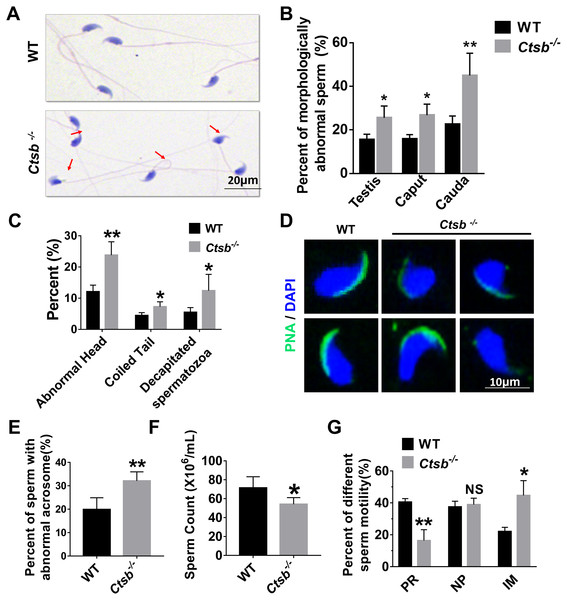 Histology and sperm quality analysis of Ctsb-/- mice.