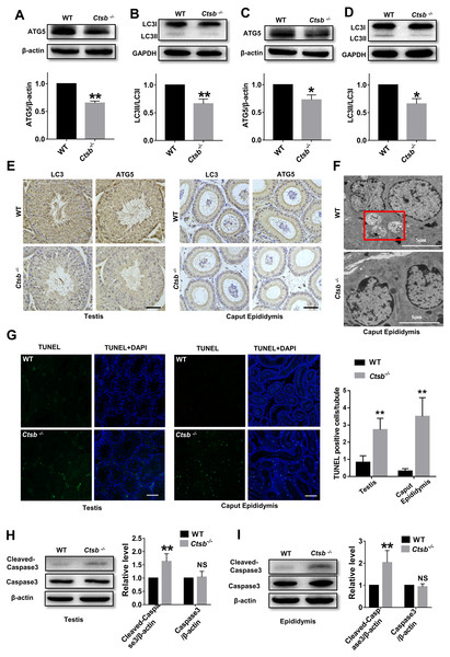 Autophagic and apoptotic activity detected in Ctsb-/- male mice.