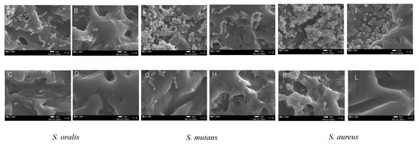 Scanning electron microscope (SEM) images of bacterial biofilms formed on the surface of ethylene-vinyl acetate(EVA) sheets.