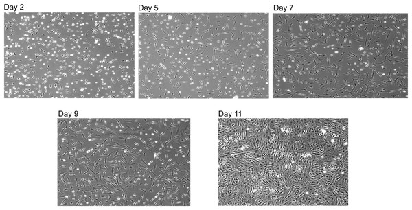 Reconstituted SNZR PL drives cell proliferation.
