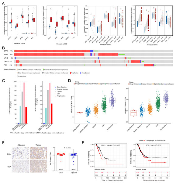 The clinical and multi-omics data of mitochondrial dynamics-related genes (MFN1/2, OPA1, DNM1L and Fis1) in NSCLC tumor tissues.