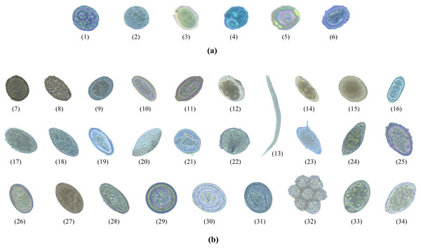 The total 34 classes of parasitic objects: (A) protozoan cysts and (B) helminthic eggs.