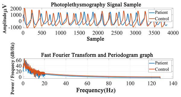 Periodogram graph of the photoplethysmography signal.