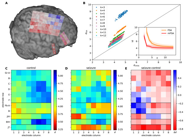 mFSA and FSA dimension estimates on intracranial brain-LFP measurements during interictal activity and epileptic seizures.