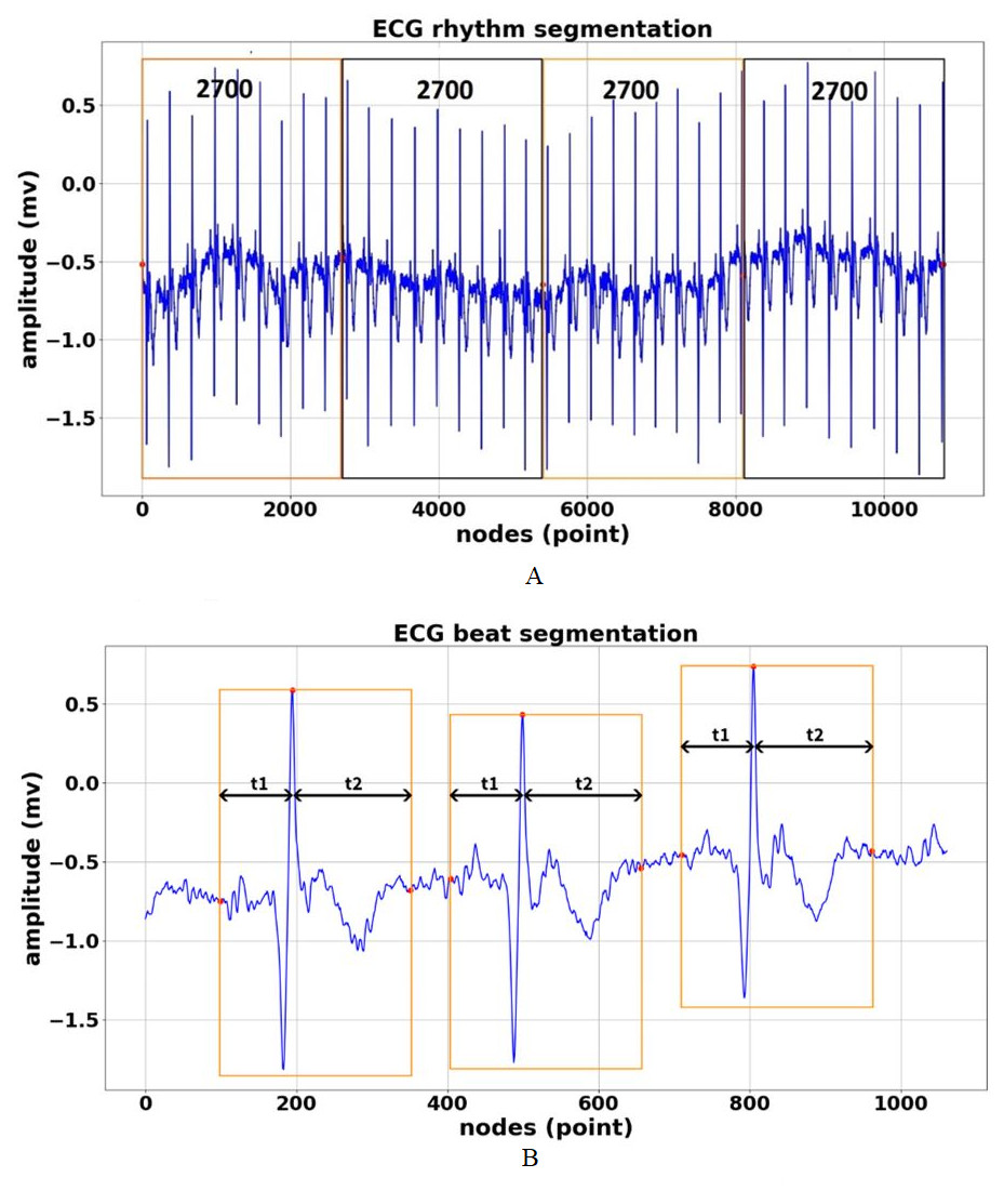 Deep Learning-based Electrocardiogram Rhythm And Beat Features For ...