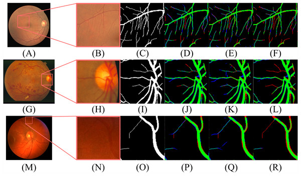 The contrast of the final fusion output probability map and output of double decoders.