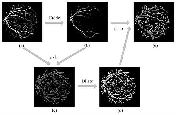 Hard example masks extracted by morphology.