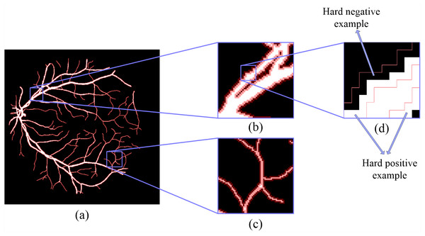 The details of hard example masks are extracted by morphology-based method.