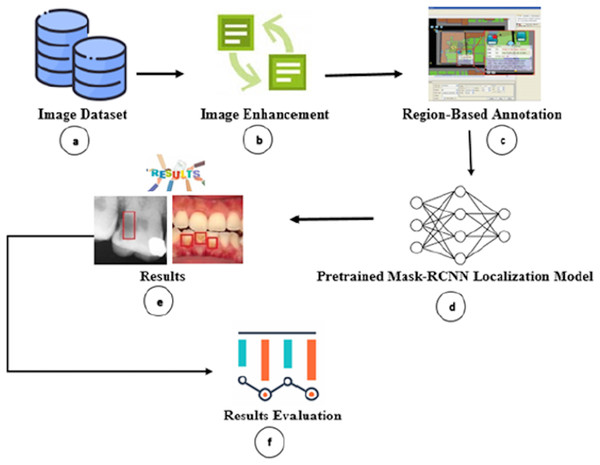 Overview of proposed carious regions detection and localization.