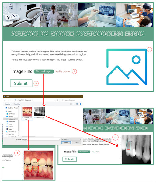Proposed dental cavity detection tool: (A) image upload, (B) submit button, (C) output image area, (D) X-ray image output, and (E) colored image output.