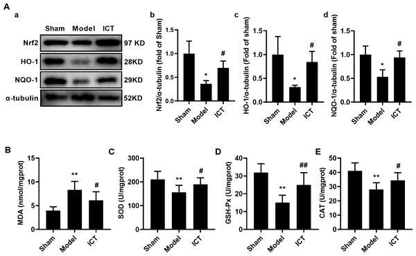 ICT protects against oxidative stress in brain tissue of MCAO/R mice.