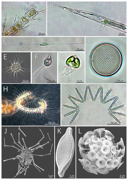 Micrographs of dominant species at Station 1 (ST1), Station 2 (ST2) and Station 3 (ST3).