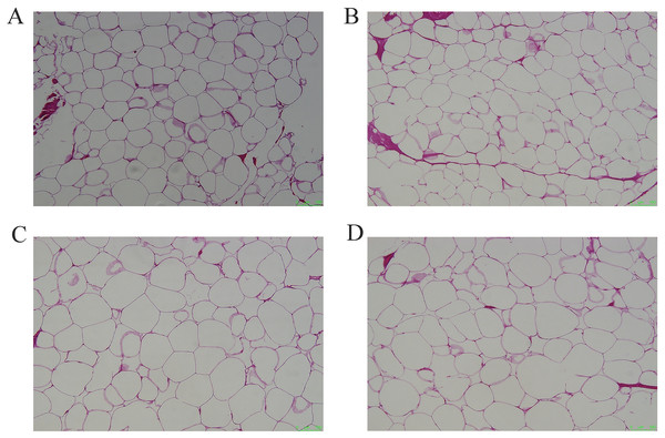 Representative pictures of HE staining of different adipose tissues.