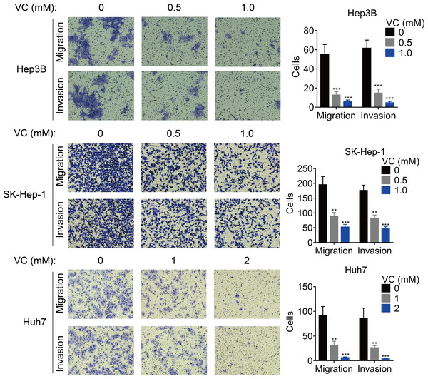 VC inhibits the proliferation, migration and invasion of HCC cells.