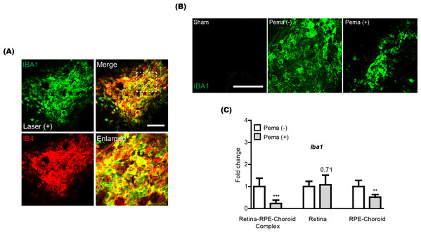 Reduction of activated microglia by oral pemafibrate administration in a mouse model of neovascular age-related macular degeneration (AMD).