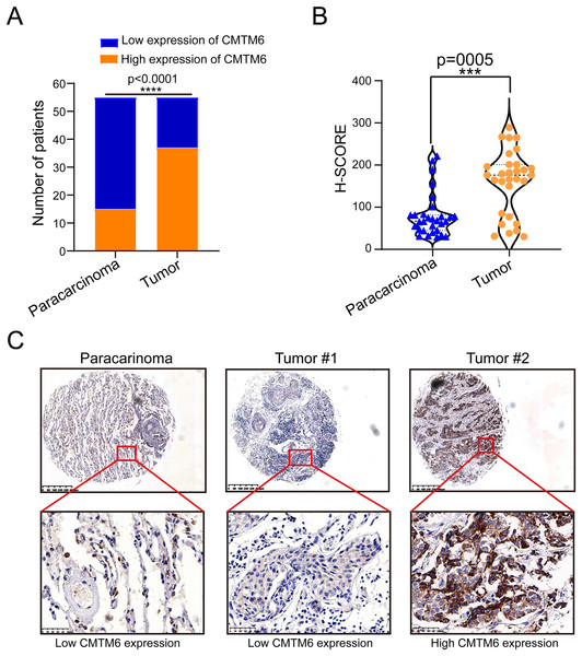 CMTM6 is upregulated in LUAD tissues based on IHC.