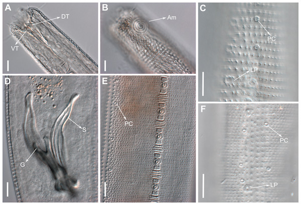 Pomponema longispiculum sp. nov., lightning micrographs, male.