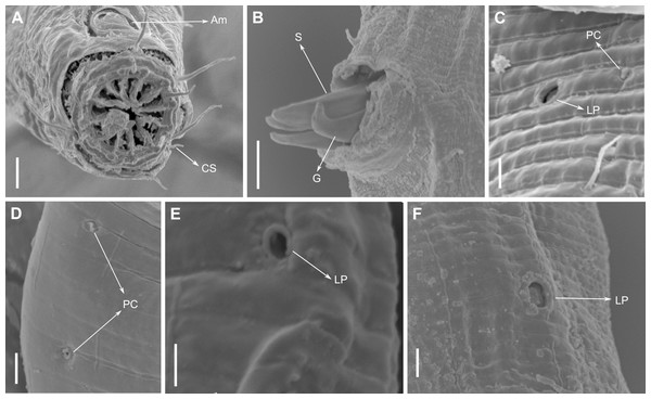 Pomponema longispiculum sp. nov., scanning electron micrographs, male.