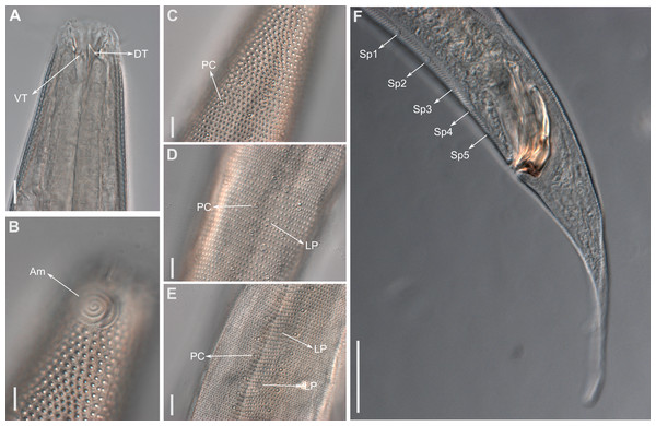 Biarmifer nesiotes sp. nov., light micrographs, male.