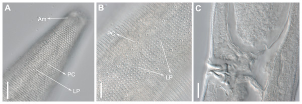 Biarmifer nesiotes sp. nov, lightning micrographs, female.