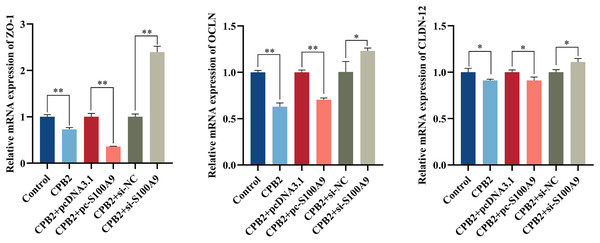 Effects of S100A9 on CPB2 toxin-induced tight junction protein expression in IPEC-J2 cells.