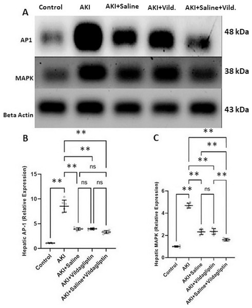 Western blot analysis of hepatic expression AP1 and MAPK in the studied groups.