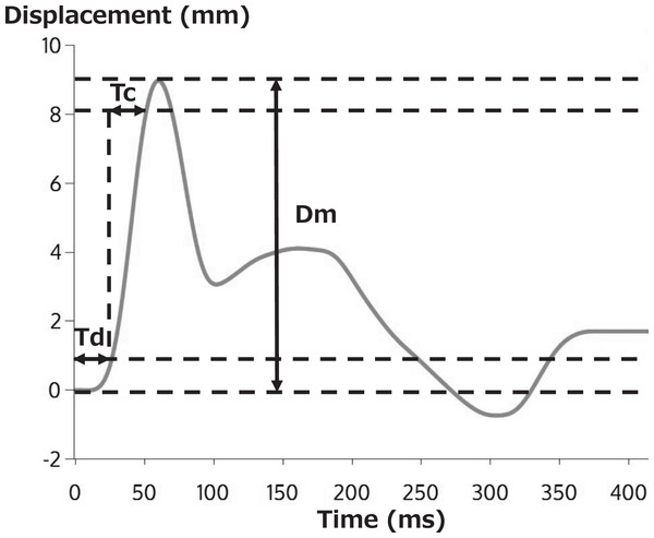 Typical TMG measurement results.