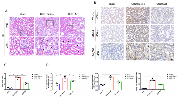 Act attenuates the renal inflammation and injury in unilateral obstruction (UUO) rat models.