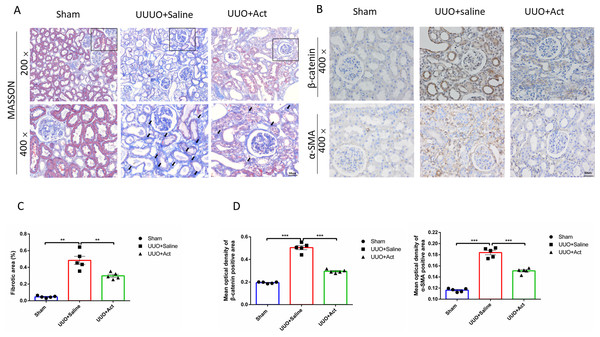 Act reduced the accumulation of collagen fibers and the expression of key proteins involved in UUO-induced renal fibrosis.
