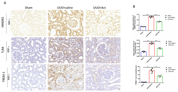 HMGN1, TLR4, and TREM-1 protein levels in the kidney of different experimental groups.