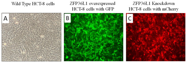 Overexpression and knockdown of ZFP36L1 in HCT-8 cells.
