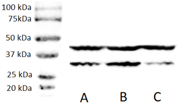 Western blot for confirming ZFP36L1 overexpression and knockdown in HCT-8 cells.