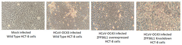 Effect of ZFP36L1 expression on Human coronavirus-OC43 induced cytopathic effect in HCT-8 cells.