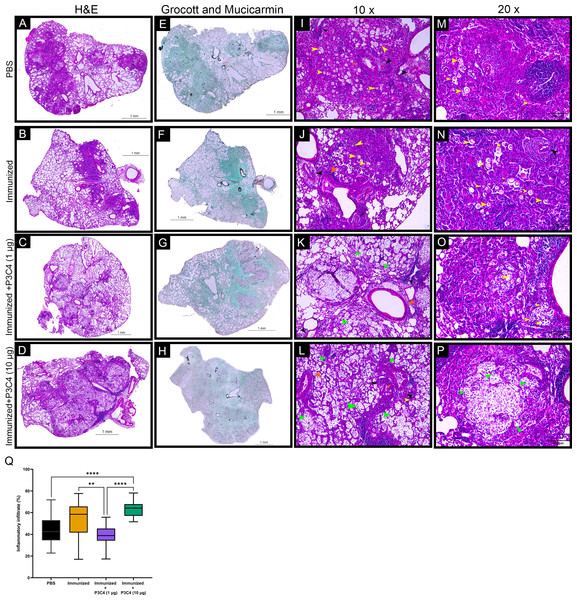 Histopathological and morphometric analysis of the lungs of immunized mice in association with adjuvant P3C4.