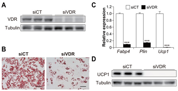 Vitamin D receptor (VDR) knockdown attenuated the brown adipocyte differentiation of C3H10T1/2 cells.