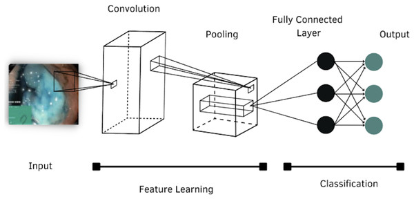 Architecture of a convolutional neural network.