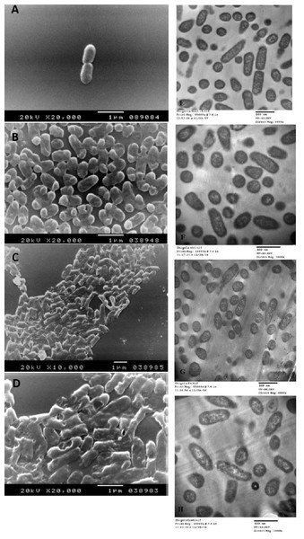 Scanning electron microscope images (A–D) and transmission electron microscope images (E–H).