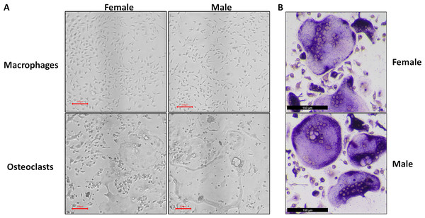 Representative micrographs of undifferentiated macrophages and osteoclasts.
