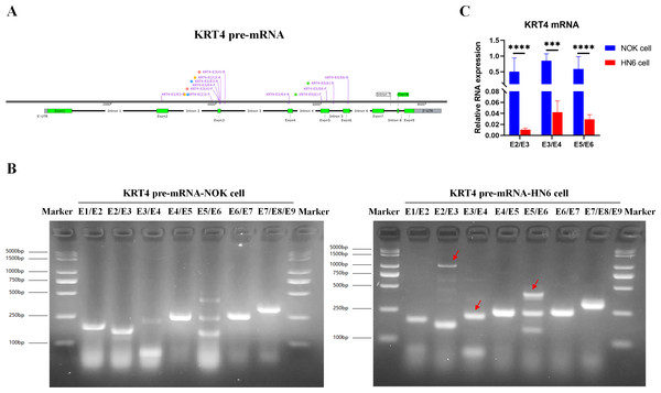 Intron splicing of KRT4 pre-mRNA is suppressed in OSCC.
