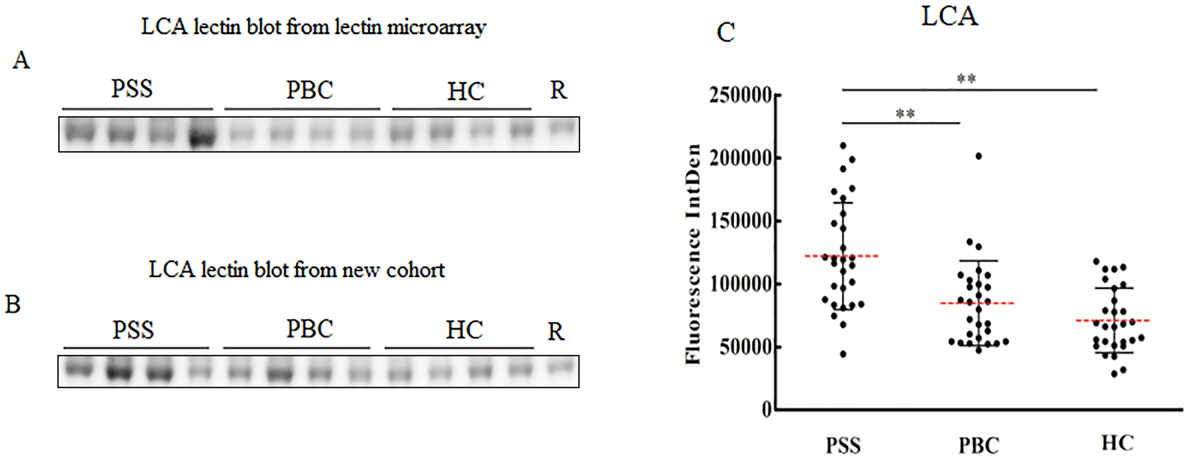 Altered Fc galactosylation in IgG4 is a potential serum marker for