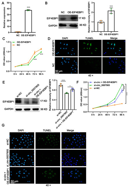 Has_circ_0007905 inhibits proliferation and promotes apoptosis via EIF4EBP1 in lens epithelial cells.