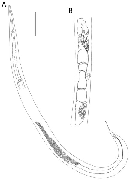 Crenopharynx crassipapilla sp. nov.