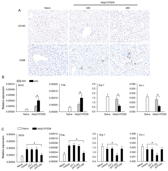 TLR2 and TLR4 ligands induce liver resident macrophages polarization in AIH.