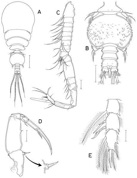 Asterocheres banderaae n. sp., male.