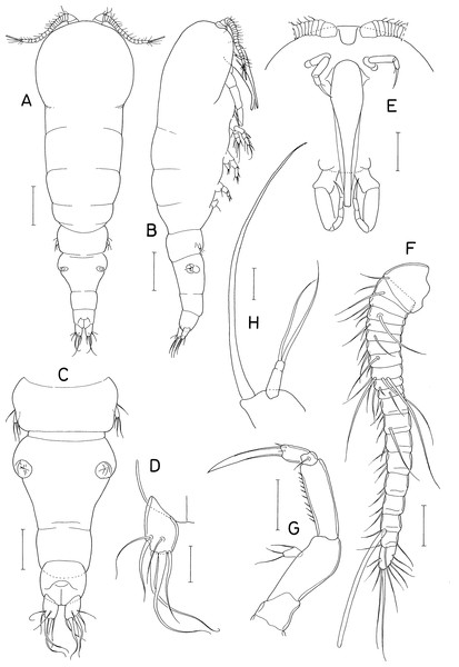 Amalomyzon elongatum n. gen. n. sp., female.
