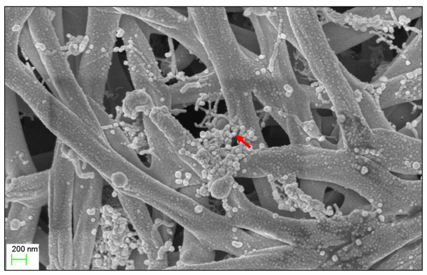 Scanning electron microscope of Streptomyces KB1.