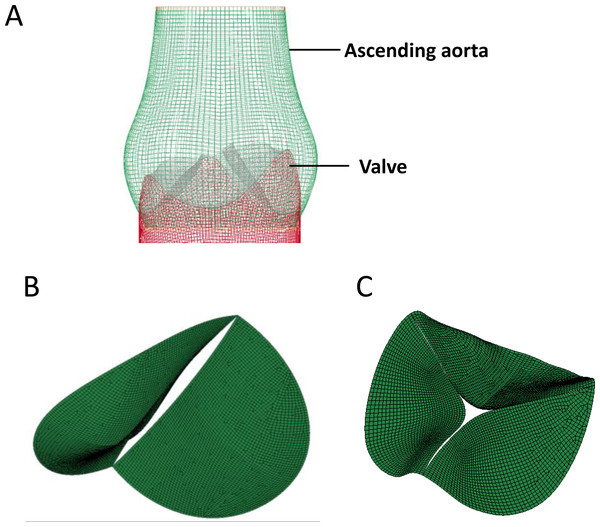 The construction of FEM model of aortic valve.