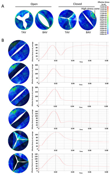 Analysis of the equivalent stress on heart valves during the cardiac cycle at the pressure difference of 25 mmHg.
