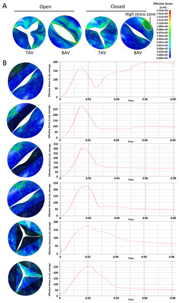 Analysis of the equivalent stress on heart valves during the cardiac cycle at the pressure difference of 50 mmHg.