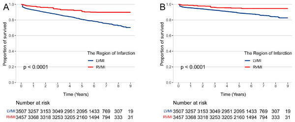 The risk of mortality in patients with right and left ventricular myocardial infarction.